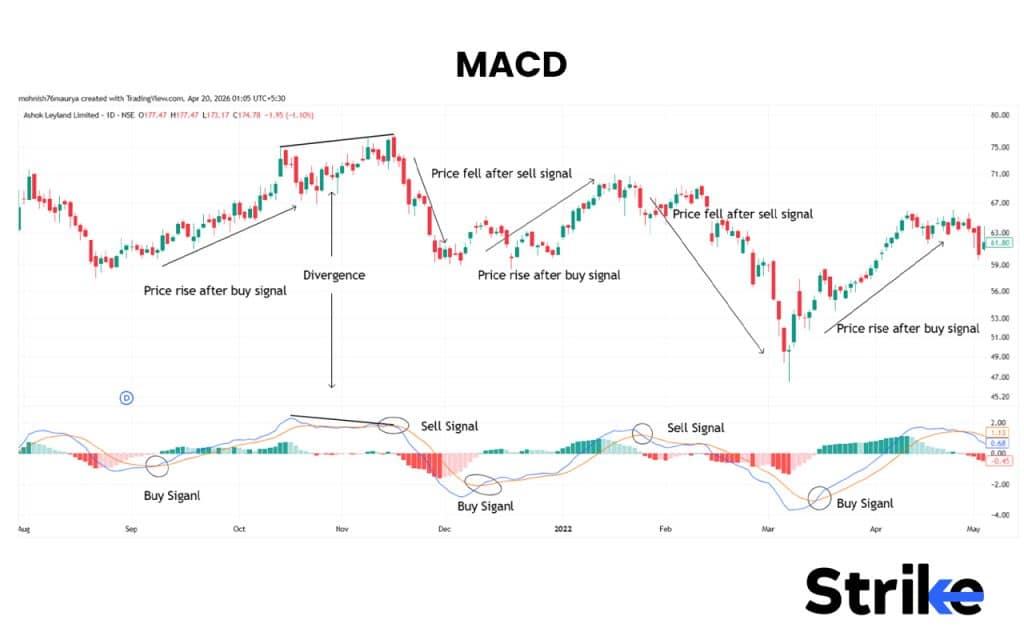 MACD